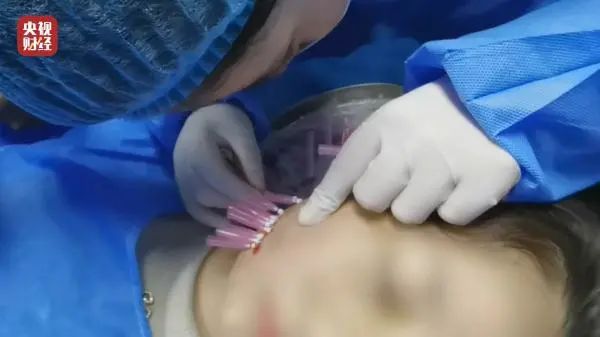 女子醫(yī)美注射針劑致死事件，女兒揭露真相